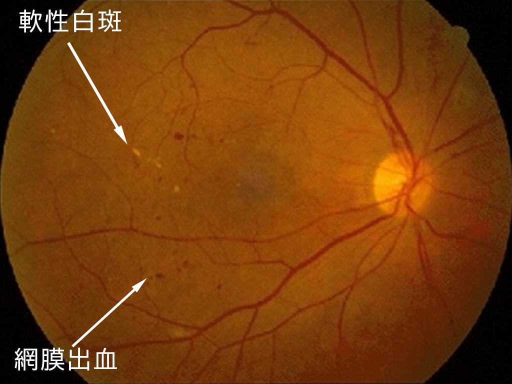 写真：症例